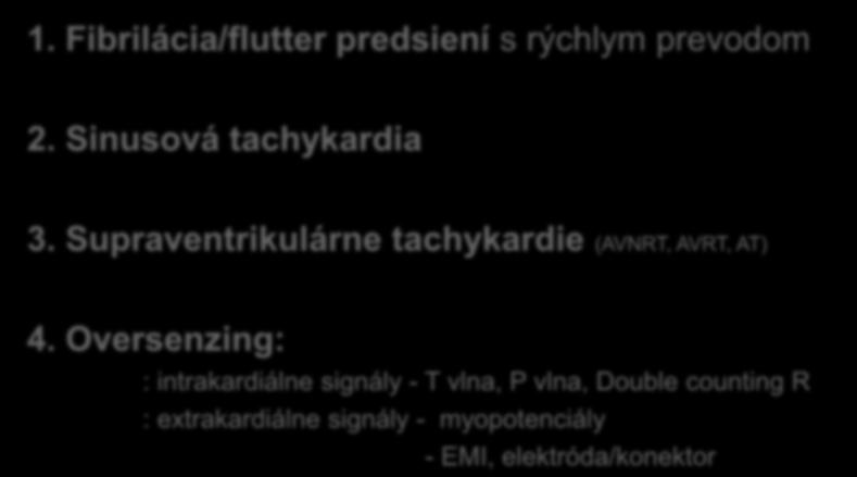 Príčiny neadekvátnej ICD terapie 1. Fibrilácia/flutter predsiení s rýchlym prevodom 2. Sinusová tachykardia 3.