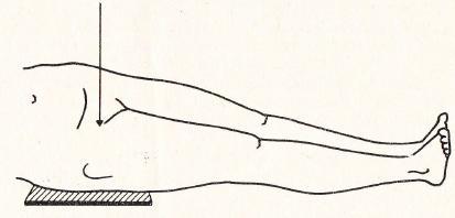 Předozadní projekce se provádí u pacienta v leţe. Dolní končetiny jsou nataţeny, nohy jsou vytočeny tak, aby se palce dotýkaly a paty byly od sebe mírně oddáleny.