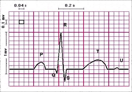 MĚŘENÍ TK, MINUTOVÝ OBJEM SRDCE, EKG Protokol č.