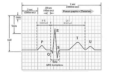 PŘÍKLADY APLIKACÍ NEURONOVÝCH SÍTÍ 140 myokardu, neléčenou chlopenní vadu, atd.) Zvláštní význam má EKG při studiu poruch srdečního rytmu. EKG snímá časovou závislost elektrické aktivity srdce.