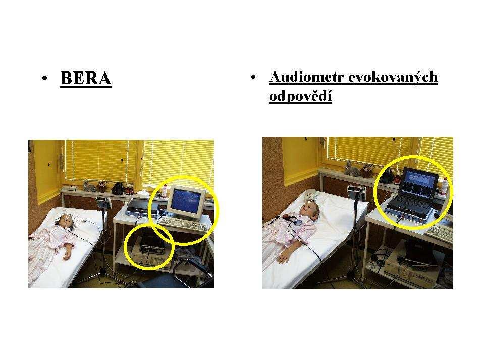 Analyzátory otoakustických emisí: Capella: Klinický analyzátor je