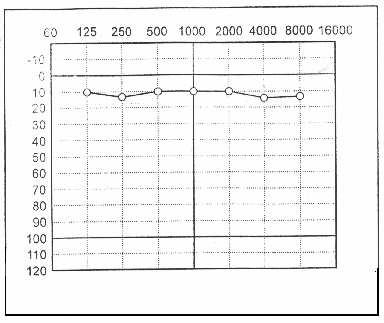 c) audiogram normální