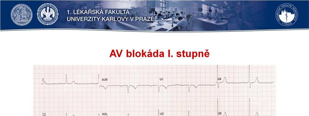 Interval PQ není fixní parametr, je přímo