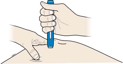 Krok 3: Podání injekce G. Udržujte napnutí nebo stisk.