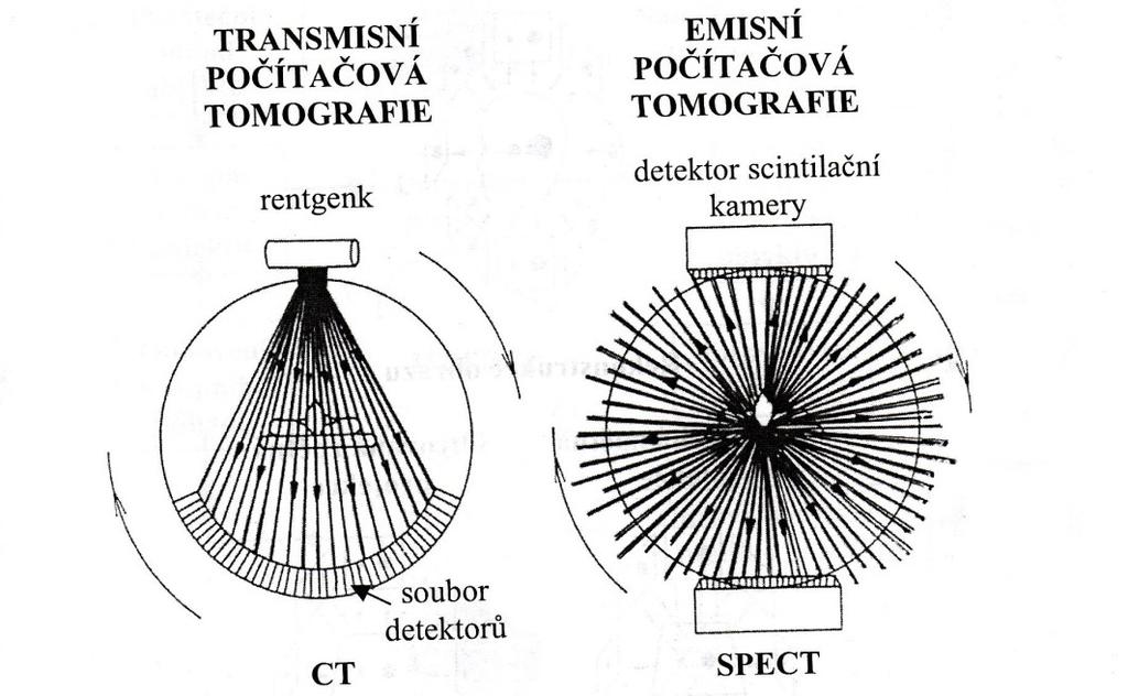 6. Vyšetřovací metody V nukleární medicíně se vyšetřuje pomocí statické a dynamické scintigrafie. Při scintigrafii myokardu se používá tomografie.