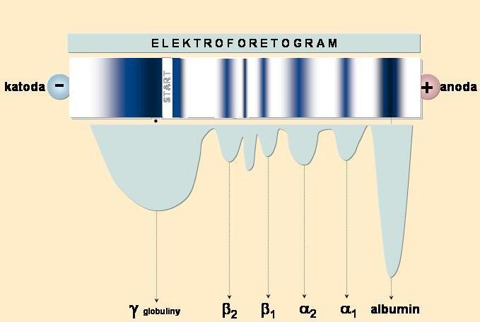 Elektroforéza séra základní