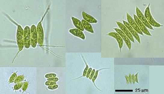 Chlorophyceae, Scenedesmaceae Scenedesmus