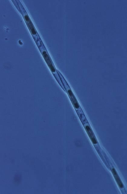 Systematika zelených kokálních řas biologický koncept druhu