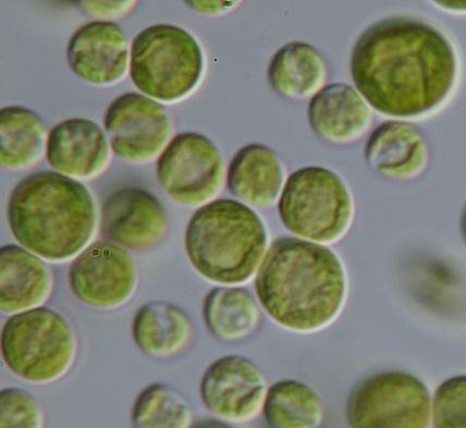 Chlorophyceae, mnohojaderné rody Mnohojaderné buňky,