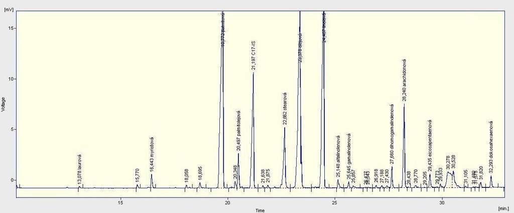 5.1. Chromatografické stanovení celkových mastných kyselin Chromatografický záznam spektra methylesterů celkových mastných kyselin v plazmě je uveden na Obr. 22.