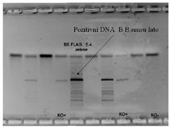 Obr. 5A Obr. 5B Obr. 5. Výsledky metody PCR (A, B) Označený proužek (šipka) prokazuje pozitivní DNA borelií metodou PCR (polymerase chain reaction). Fig. 5. The results of PCR (A, B) The stripes (arrows) indicate positive PCR (polymerase chain reaction) for DNA of Borrelia.