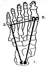 1 TEORETICKÁ VÝCHODISKA DANÉ PROBLEMATIKY Kloub Lisfrankův je označením pro linii tarsometatarsálních kloubů vedoucí napříč nohou (Čihák, 20