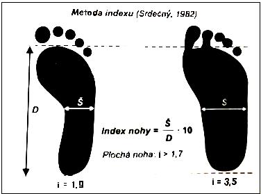 3 METODIKA VÝZKUMU 3.4 METODY VYHODNOCENÍ Pro své testování jsem si vybrala metodu indexu dle Srdečného. Tato metoda je jednoduchá, levná, časově méně náročná a dobře proveditelná ve školní praxi.