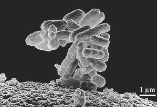 Ze současné medicíny Bakterie Escherichia coli od nezbytného komenzála po nebezpečného patogena LENKA MICENKOVÁ Bakterie Escherichia coli (E.