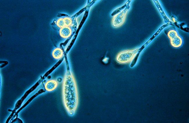 ŘÁD: MONOBLEPHARIDALES Cenocytické mycelium, rozvětvené, rhizoidy upevňují stélku,