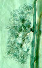 : GLOMALES Hodně druhů vytváří endomykorhizu