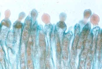 Řád: ENTOMOPHTHORALES Mycelium v mládí coenocytické, později přehrádky,