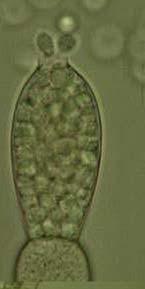 gametangium uvolňující gamety (anizogamie) Primárně vodní organismy, ale často i v půdě; saprofyté, parazité (na