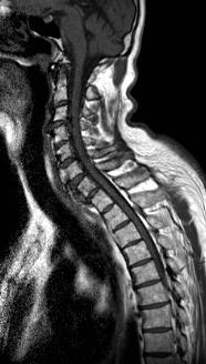 a osifikace ligamentzejm. v oblasti lig.