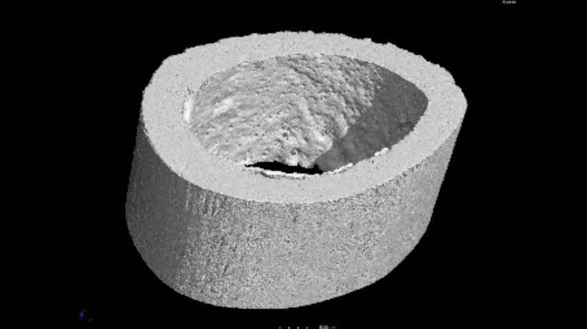mm Voxelové rozlišení: 8 µm Analyzovaný