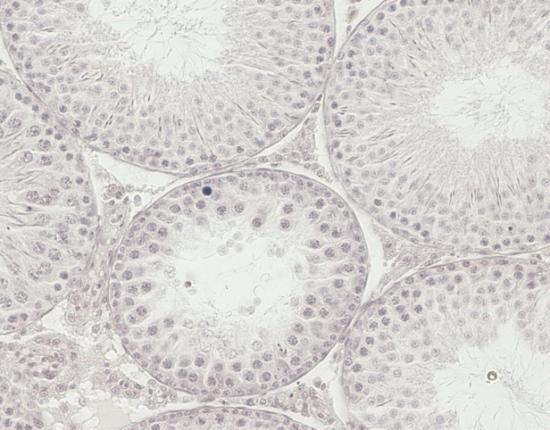 TUNEL pozitivní peritubulární myoidní buňky (Obr. 38B).