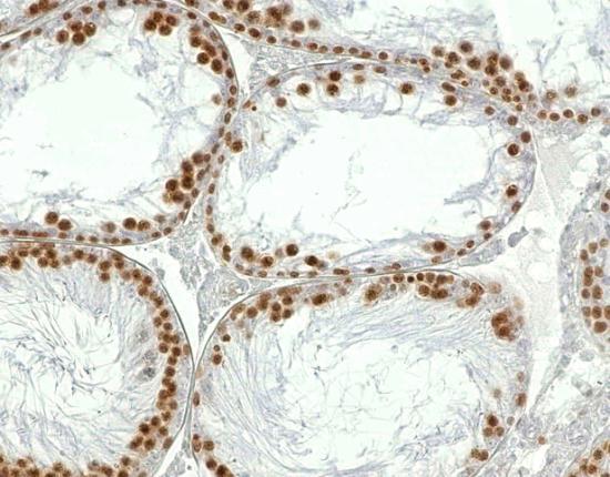 PCNA pozitivitu těchto spermatogonií (společně s