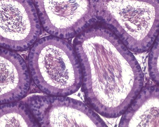 Výsledková část - Kryptorchismus spermatogonií a spermatocytů při bazální membráně (Obr. 2A).