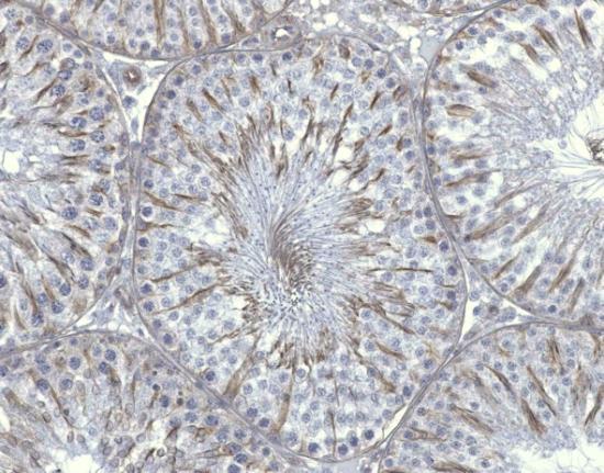 Druhým typem buněk v zárodečném epitelu, v nichţ se nacházel tubulin, byly elongované spermatidy. V intersticiální tkáni jsme tubulin detekovali především ve stěně cév (Obr. 18A šipka). A B Obrázek č.