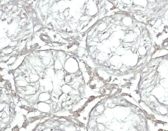 Dobarveno hematoxylinem, originální zvětšení - 200 V posledních časových intervalech (28, 42 a 70 dnů) jsme