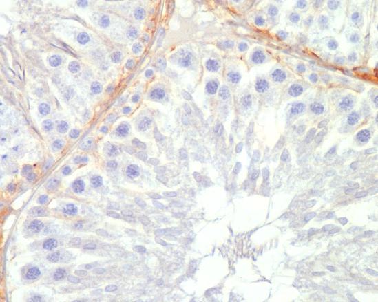 Dobarveno hematoxylinem, originální zvětšení (A) 100, (B, C) 200 Exprese connexinu 43 v semenotvorných kanálcích kontrolních varlat byla