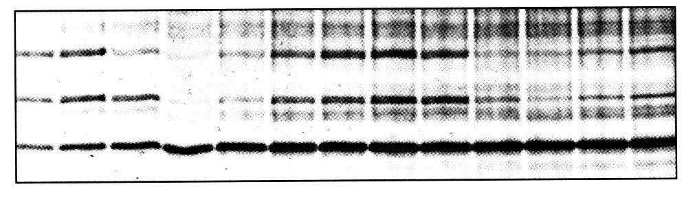 Newly synthesized proteins labeled with 35 S-methionine: Mitosis