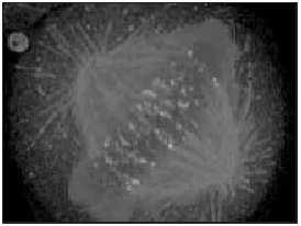 Mitóza Mitóza v lidské buňce pozorovaná fluorescenční mikroskopií.