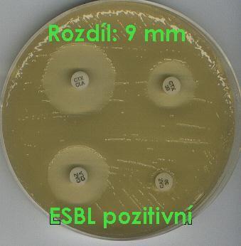 Zjišťování faktorů rezistence Někdy je lépe speciálními metodami zjišťovat přítomnost konkrétních faktorů rezistence, např.