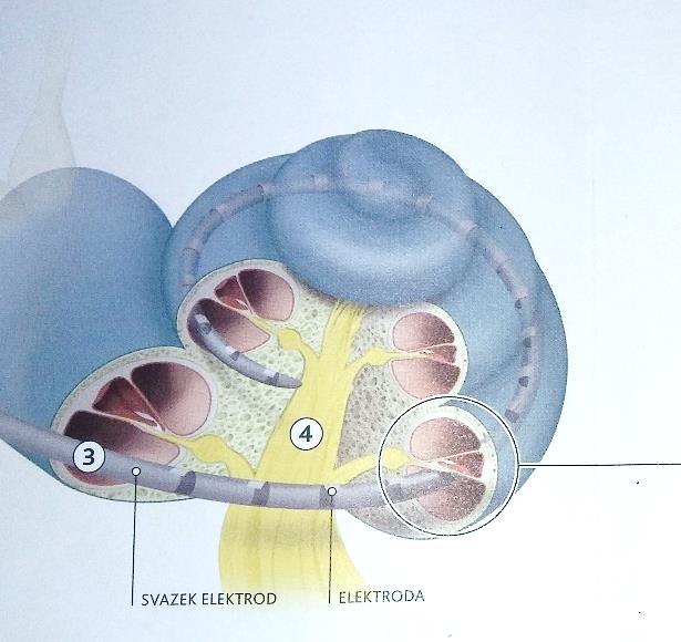 materiály firmy Cochlear TM Kochleární