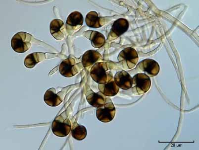 Anamorfy vegetativní mycelium konidie konidiogenní buňka