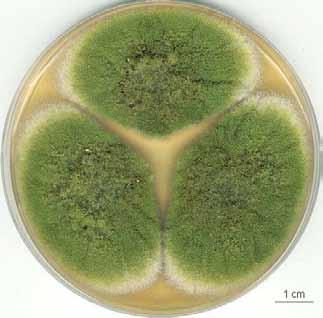 Pezizomycotina Eurotiomycetes Eurotiales Aspergillus