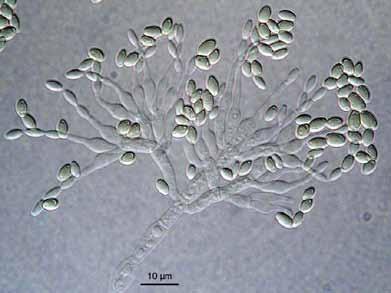 Pezizomycotina Eurotiomycetes Eurotiales