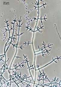 Trichoderma harzianum - běžný druh