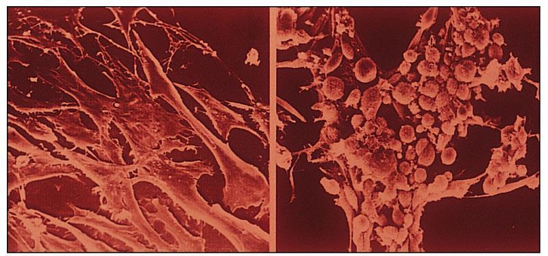 buňky - Působení virů na hostitelskou buňku: - Lyze buněk rostoucích v monovrstvě tvorba plak - Změna