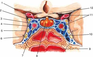 communicans posterior; 2 n. oculomotorius (n.iii); 3 n. trochlearis (n.iv); 4 sinus cavernosus; 5 n.