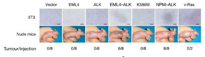 EML4-ALK aberrant fusion gene encodes a cytoplasmic chimeric