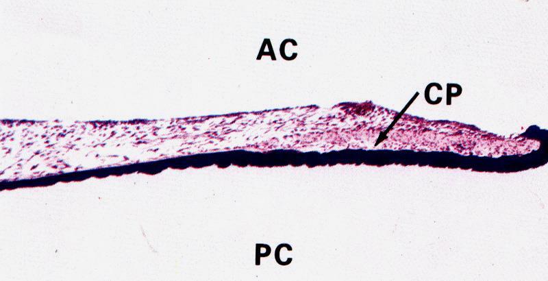 Duhovka = Iris plicae iridis, stroma iridis přední plocha nemá epitelový kryt (stratum limitans anterius) fibroblasty a melanocyty (barva) plica radians = zubatá čára