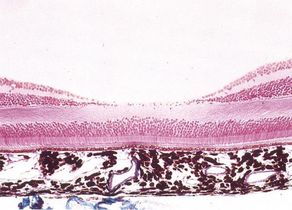 Tunica sensoria (interna) Specifická místa sítnice ora serrata - ukončení senzorického epitelu pars optica