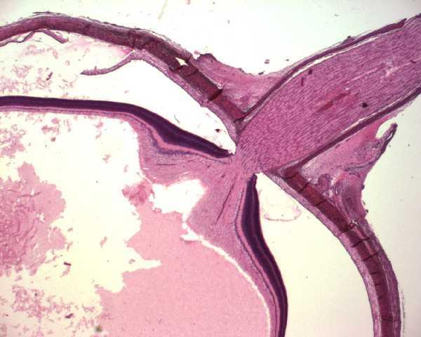 optici /dříve papilla/ (= slepá skvrna) místo odstupu nervu žádné světločivné elementy excavatio disci