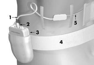 Odstránenie testovacích elektród, predĺžení a rozdeľovačov 3. Nasaďte pacientovi testovací pás, odstrihnite prebytočnú dĺžku a vložte do vrecka na páse testovací stimulátor. 1. Kábel OR 4.