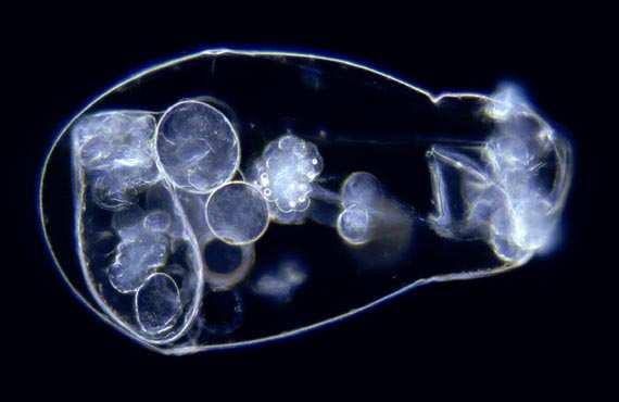 Asplanchna (vakovenka) - běžné planktonní druhy.