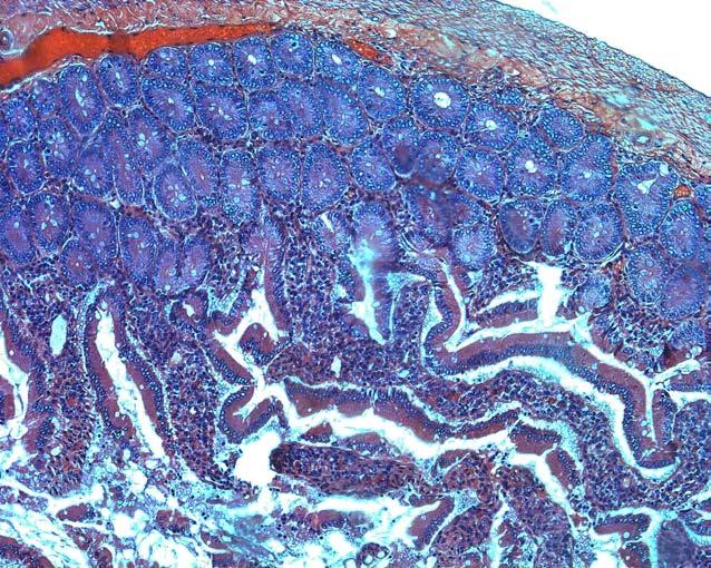 Obrázek 11: Přehledný řez duodenem vykazuje nezměněnou strukturu všech jeho komponent.