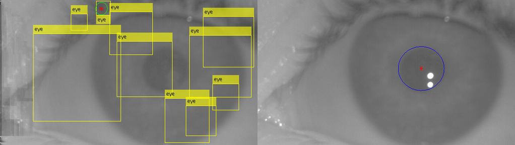 Zde je dokonce zřejmé, že detekovaná elipsa lépe odpovídá hledané zornici. Obrázek 6.4. Porovnání kaskádního detektoru s refererencí EyeGaze SDK, negativní příklad.