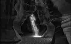 romantickou krajinou Edwarda Steichena Jezírko měsíční světlo z roku 1904, kterou před deseti lety prodalo Metropolitní muzeum v New Yorku za necelé tři miliony dolarů jako nadbytečnou variantu