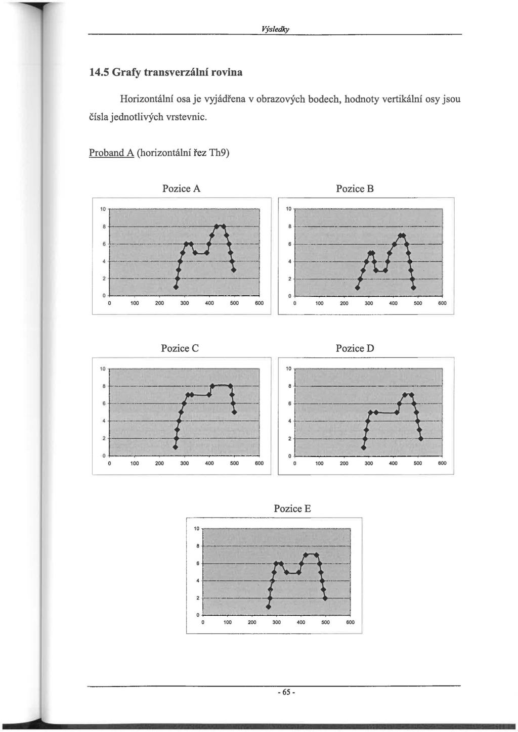 Výsledky 14.5 Grafy transverzální rovina Horizontální osa je vyjádřena v obrazových bodech, hodnoty vertikální osy jsou čísla jednotlivých vrstevnic. Proband A (horizontální řez Th9) Pozice A 'l-.